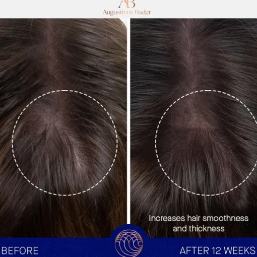 Augustinus Bader The Hair Oil