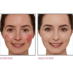 Bye Bye Neutralizing Correcting Cream Bye Bye Redness von it Cosmetics