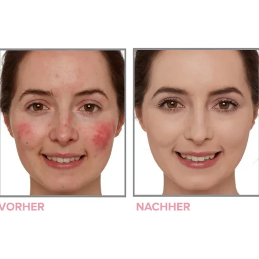 Bye Bye Neutralizing Correcting Cream Bye Bye Redness von it Cosmetics