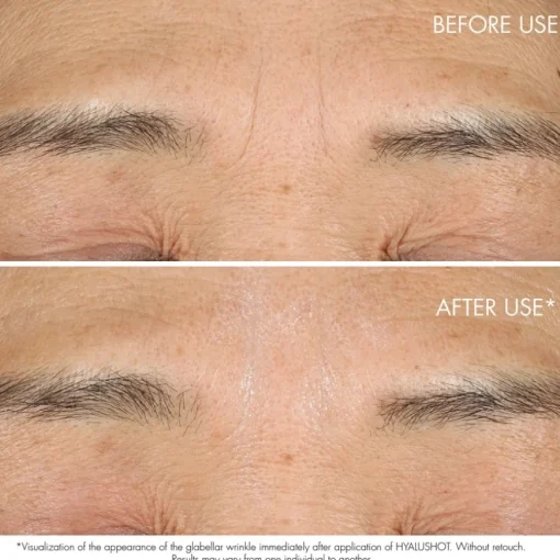 Capture Totale Hyalushot von DIOR