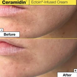 Ceramidin Feuchtigkeitsspendende Gesichtscreme mit Ceramiden von Dr. Jart+