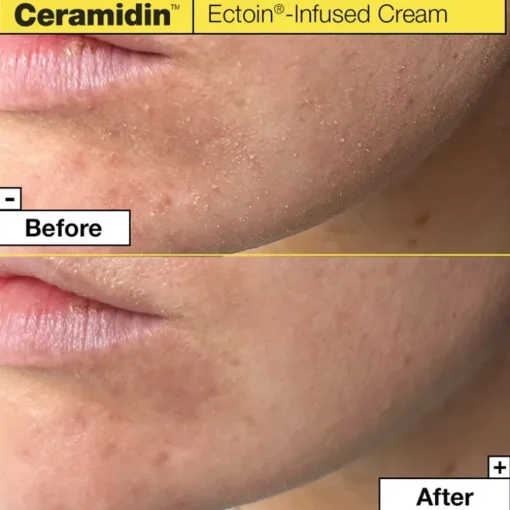 Ceramidin Feuchtigkeitsspendende Gesichtscreme mit Ceramiden von Dr. Jart+