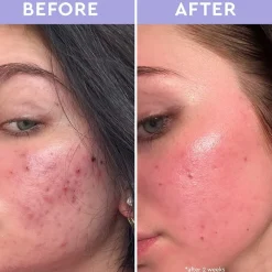 Cleanse Spot a Spot Exfoliating Blemish Solution von florence by mills