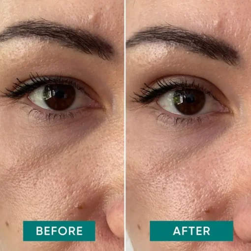Gesicht Eyelid Lifting Tapes von APRICOT
