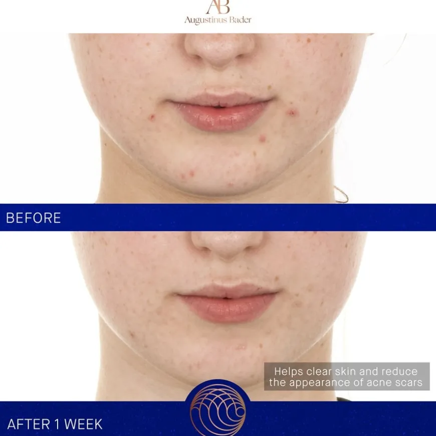 Gesicht The Retinol Serum von Augustinus Bader