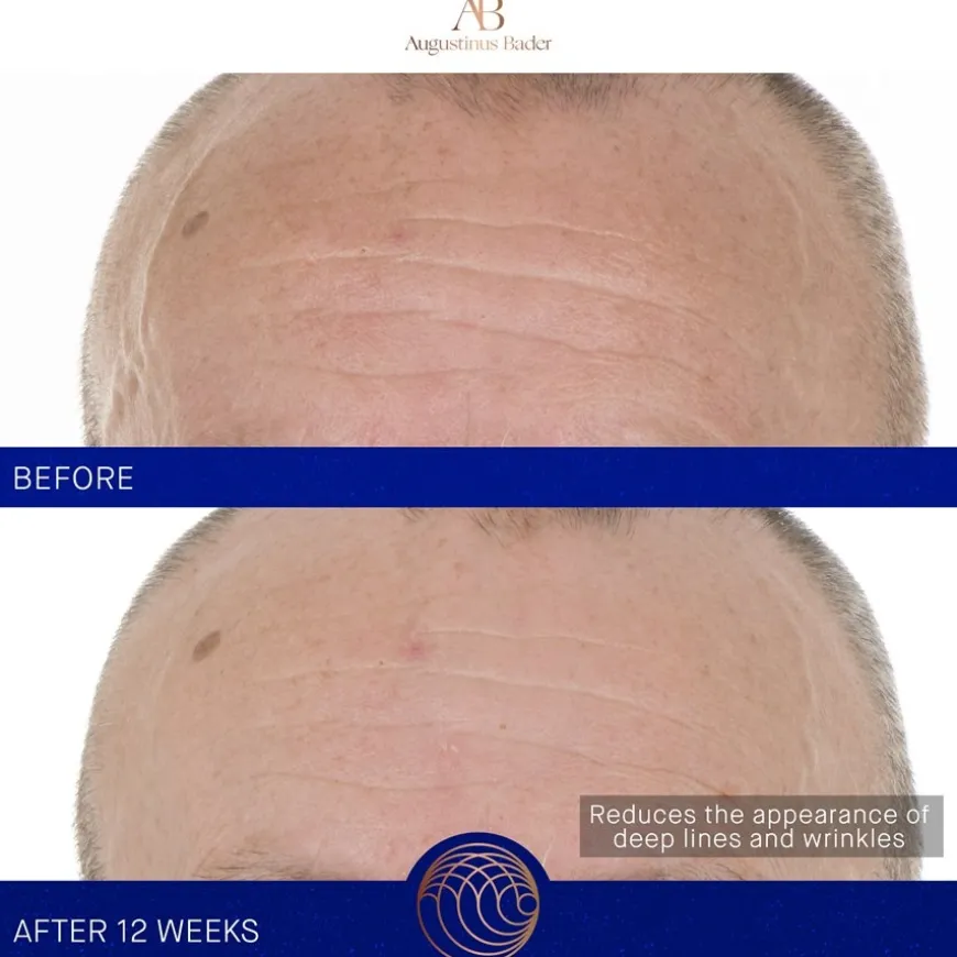 Gesicht The Retinol Serum von Augustinus Bader