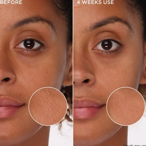 Gesichtsreinigung the POREfessional Tight 'n Toned - Poren verfeinernder Schaum-Toner mit AHA+PHA Mini von Benefit