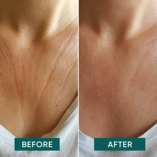 Körper Decolleté Pad mit Vitamin C - décolleté delight von APRICOT
