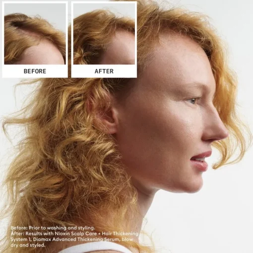 Naturbelassenes, dezent dünner werdendes Haar Scalp Therapy Revitalising Conditioner Natural Hair Progressed Thinning von Nioxin