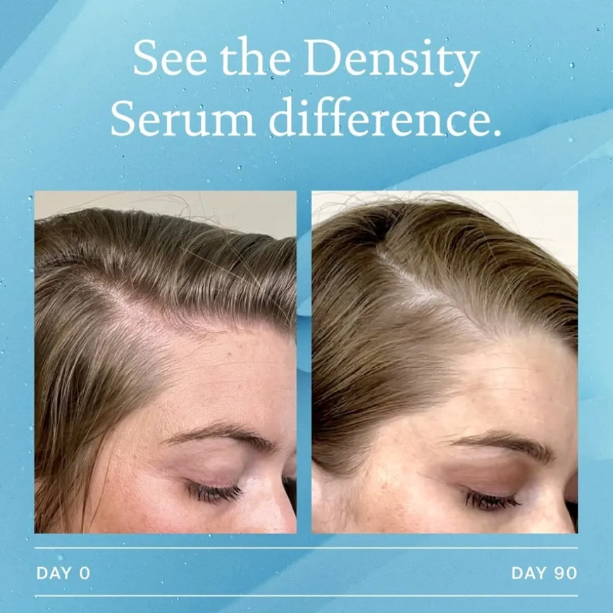 Scalp Care Density Serum von Living Proof