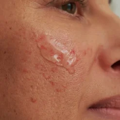 SENSACEA REINIGUNGSGEL - bei hypersensibler Haut & Couperose von DADO SENS
